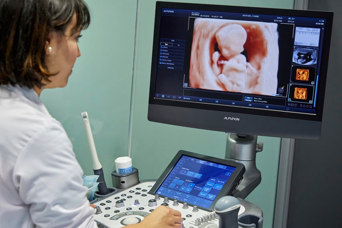 4D ultrazvuk dieťaťa v maternici. Foto: JAVIER LARREA / Sciencephoto / Profimedia