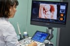 4D ultrazvuk dieťaťa v maternici. Foto: JAVIER LARREA / Sciencephoto / Profimedia